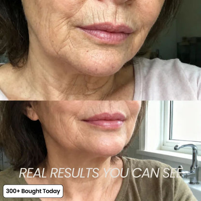 PDRN Collagen Volume Multi Balm