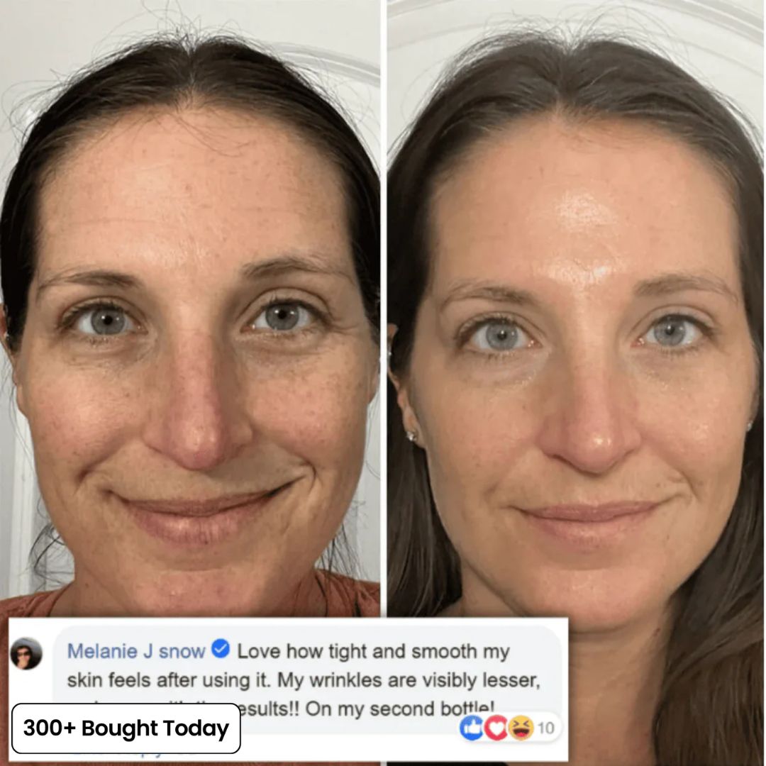 PDRN Collagen Volume Multi Balm